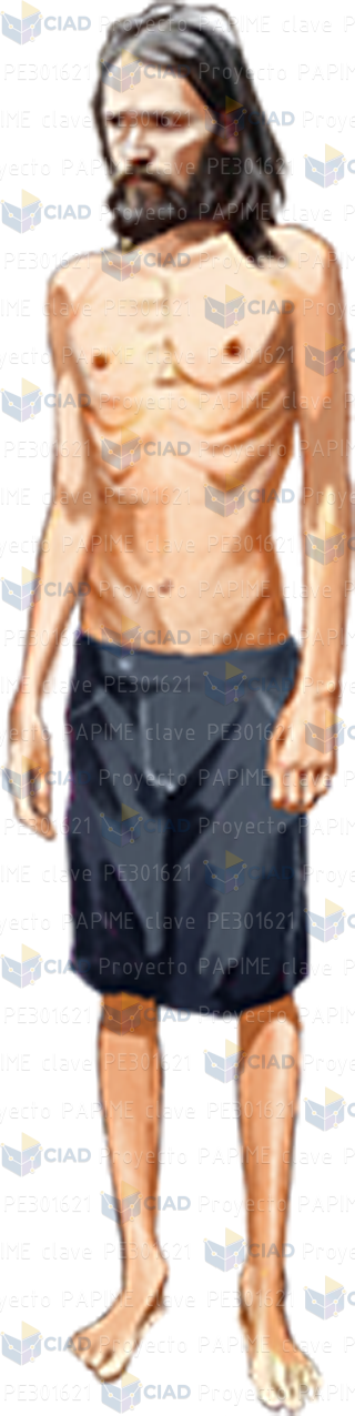 Hombre desnutrido con bermudas